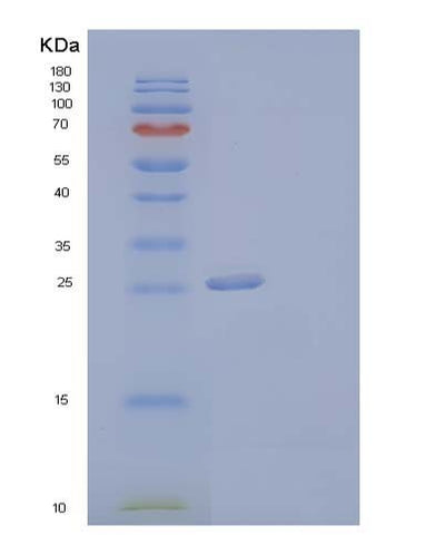 SDS-PAGE analysis of Human F3 (Tissue Factor) - Recombinant Protein, CAT# BLT-04060P, showing >90% purity under 15% SDS-PAGE (Reduced)Human F3 (Tissue Factor) - Recombinant Protein
