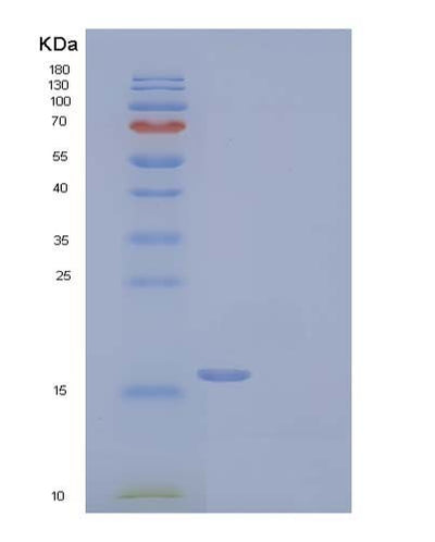 SDS-PAGE analysis of Human CCN2 (Ccn Family Member 2) - Recombinant Protein, CAT# BLT-04077P, showing >95% purity under 15% SDS-PAGE (Reduced)Human CCN2 (Ccn Family Member 2) - Recombinant Protein