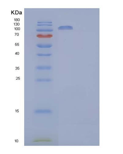 SDS-PAGE analysis of Human CNTN2 (Contactin-2) - Recombinant Protein, CAT# BLT-04079P, showing >85% purity under 15% SDS-PAGE (Reduced)Human CNTN2 (Contactin-2) - Recombinant Protein