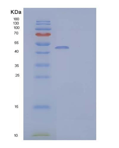SDS-PAGE analysis of Human PNLIPRP2 (Pancreatic Lipase-Related Protein 2) - Recombinant Protein, CAT# BLT-04088P, showing >85% purity under 15% SDS-PAGE (Reduced)Human PNLIPRP2 (Pancreatic Lipase-Related Protein 2) - Recombinant Protein