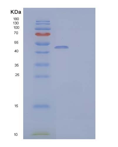 SDS-PAGE analysis of Human PNLIPRP2 (Pancreatic Lipase-Related Protein 2) - Recombinant Protein, CATHuman PNLIPRP2 (Pancreatic Lipase-Related Protein 2) - Recombinant Protein