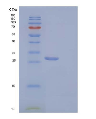 SDS-PAGE analysis of Mouse Igfbp5 (Insulin-Like Growth Factor-Binding Protein 5) - Recombinant Protein, CAT# BLT-04102P, showing >90% purity under 15% SDS-PAGE (Reduced)Mouse Igfbp5 (Insulin-Like Growth Factor-Binding Protein 5) - Recombinant Protein