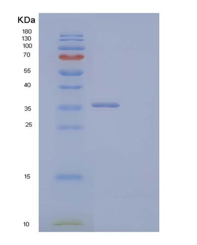 SDS-PAGE analysis of Human CCND2 (G1/S-Specific Cyclin-D2) - Recombinant Protein, CAT# BLT-04110P, showing >90% purity under 15% SDS-PAGE (Reduced)Human CCND2 (G1/S-Specific Cyclin-D2) - Recombinant Protein