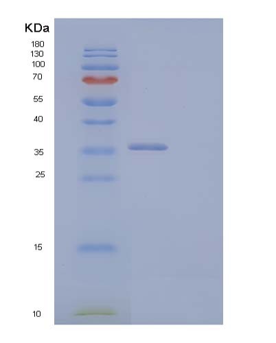 SDS-PAGE analysis of Human CCND2 (G1/S-Specific Cyclin-D2) - Recombinant Protein, CATHuman CCND2 (G1/S-Specific Cyclin-D2) - Recombinant Protein