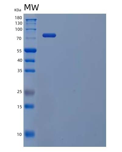 SDS-PAGE analysis of Human STAT1 (Signal Transducer And Activator Of Transcription 1-Alpha/Beta) - Recombinant Protein, CAT# BLT-04138P, showing >85% purity under 15% SDS-PAGE (Reduced)Human STAT1 (Signal Transducer And Activator Of Transcription 1-Alpha/Beta) - Recombinant Protein