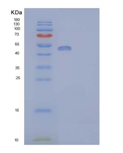SDS-PAGE analysis of Human Aldehyde dehydrogenase family 3 member A1 - Recombinant Protein, CAT# BLT-04147P, showing >85% purity under 15% SDS-PAGE (Reduced)Human Aldehyde dehydrogenase family 3 member A1 - Recombinant Protein