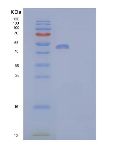 SDS-PAGE analysis of Human Aldehyde dehydrogenase family 3 member A1 - Recombinant Protein, CATHuman Aldehyde dehydrogenase family 3 member A1 - Recombinant Protein