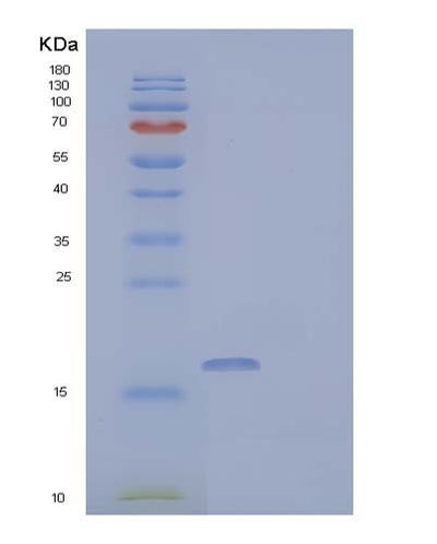 SDS-PAGE analysis of Human FABP3 (Fatty Acid-Binding Protein, Heart) - Recombinant Protein, CAT# BLT-04149P, showing >90% purity under 15% SDS-PAGE (Reduced)Human FABP3 (Fatty Acid-Binding Protein, Heart) - Recombinant Protein