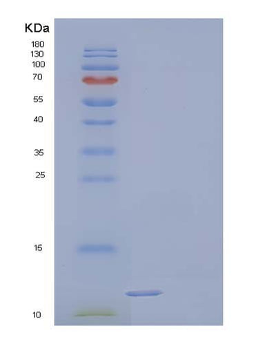 SDS-PAGE analysis of Human PDPN (Podoplanin) - Recombinant Protein, CAT# BLT-04161P, showing >90% purity under 15% SDS-PAGE (Reduced)Human PDPN (Podoplanin) - Recombinant Protein