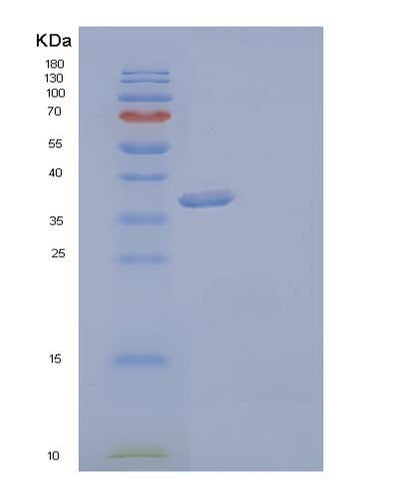 SDS-PAGE analysis of Human AKR1C3 (Aldo-Keto Reductase Family 1 Member C3) - Recombinant Protein, CAT# BLT-04166P, showing >95% purity under 15% SDS-PAGE (Reduced)Human AKR1C3 (Aldo-Keto Reductase Family 1 Member C3) - Recombinant Protein