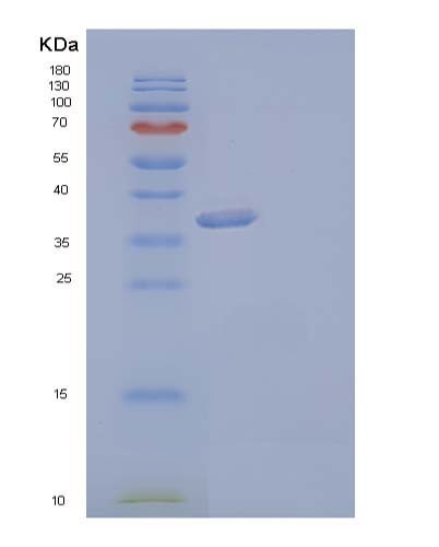 SDS-PAGE analysis of Human AKR1C3 (Aldo-Keto Reductase Family 1 Member C3) - Recombinant Protein, CATHuman AKR1C3 (Aldo-Keto Reductase Family 1 Member C3) - Recombinant Protein