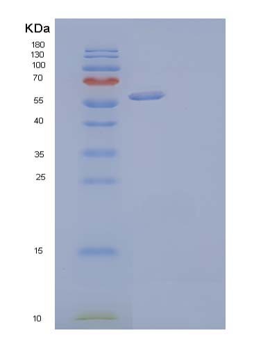 SDS-PAGE analysis of Human DKK2 (Dickkopf-Related Protein 2) - Recombinant Protein, CATHuman DKK2 (Dickkopf-Related Protein 2) - Recombinant Protein