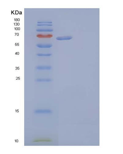 SDS-PAGE analysis of Human AFP (Alpha-Fetoprotein) - Recombinant Protein, CAT# BLT-04179P, showing >90% purity under 15% SDS-PAGE (Reduced)Human AFP (Alpha-Fetoprotein) - Recombinant Protein