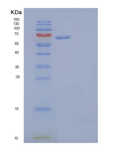 SDS-PAGE analysis of Human AFP (Alpha-Fetoprotein) - Recombinant Protein, CATHuman AFP (Alpha-Fetoprotein) - Recombinant Protein