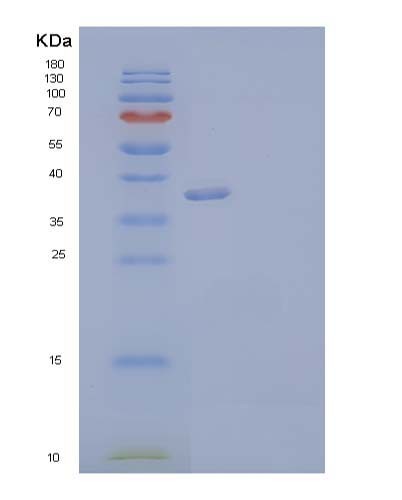 SDS-PAGE analysis of Human ANXA2 (Annexin A2) - Recombinant Protein, CATHuman ANXA2 (Annexin A2) - Recombinant Protein