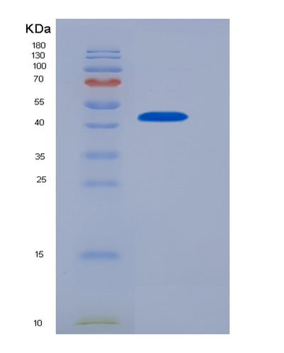 SDS-PAGE analysis of Human FCGR2A (Low Affinity Immunoglobulin Gamma Fc Region Receptor Ii-A) - Recombinant Protein, CAT# BLT-04247P, showing >85% purity under 15% SDS-PAGE (Reduced)Human FCGR2A (Low Affinity Immunoglobulin Gamma Fc Region Receptor Ii-A) - Recombinant Protein
