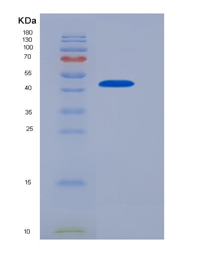 SDS-PAGE analysis of Human FCGR2A (Low Affinity Immunoglobulin Gamma Fc Region Receptor Ii-A) - Recombinant Protein, CATHuman FCGR2A (Low Affinity Immunoglobulin Gamma Fc Region Receptor Ii-A) - Recombinant Protein