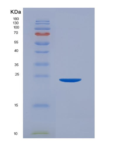 SDS-PAGE analysis of Human FCGR2A (Low Affinity Immunoglobulin Gamma Fc Region Receptor Ii-A) - Recombinant Protein, CAT# BLT-04269P, showing >95% purity under 15% SDS-PAGE (Reduced)Human FCGR2A (Low Affinity Immunoglobulin Gamma Fc Region Receptor Ii-A) - Recombinant Protein