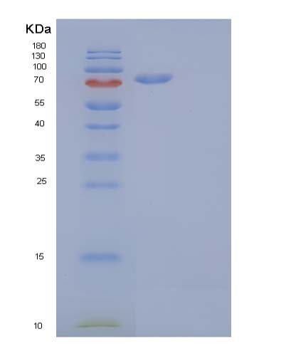 SDS-PAGE analysis of Human CDH16 (Cadherin-16) - Recombinant Protein, CATHuman CDH16 (Cadherin-16) - Recombinant Protein