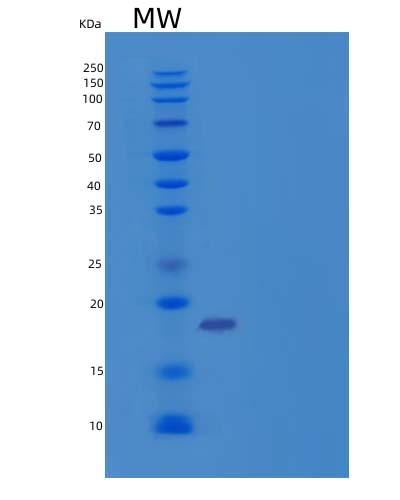 SDS-PAGE analysis of Human FGF10 (Fibroblast Growth Factor 10) - Recombinant Protein, CAT# BLT-04280P, showing >90% purity under 15% SDS-PAGE (Reduced)Human FGF10 (Fibroblast Growth Factor 10) - Recombinant Protein