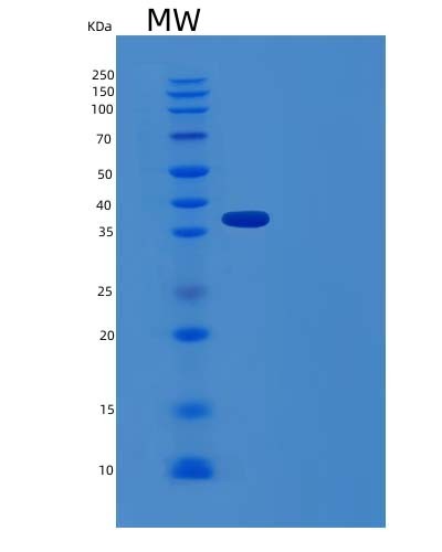 SDS-PAGE analysis of Human ACY3 (N-Acyl-Aromatic-L-Amino Acid Amidohydrolase (Carboxylate-Forming)) - Recombinant Protein, CAT# BLT-04331P, showing >90% purity under 15% SDS-PAGE (Reduced)Human ACY3 (N-Acyl-Aromatic-L-Amino Acid Amidohydrolase (Carboxylate-Forming)) - Recombinant Protein