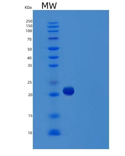 SDS-PAGE analysis of Human TNFSF15 (Tumor Necrosis Factor Ligand Superfamily Member 15) - Recombinant Protein, CAT# BLT-04340P, showing >85% purity under 15% SDS-PAGE (Reduced)Human TNFSF15 (Tumor Necrosis Factor Ligand Superfamily Member 15) - Recombinant Protein