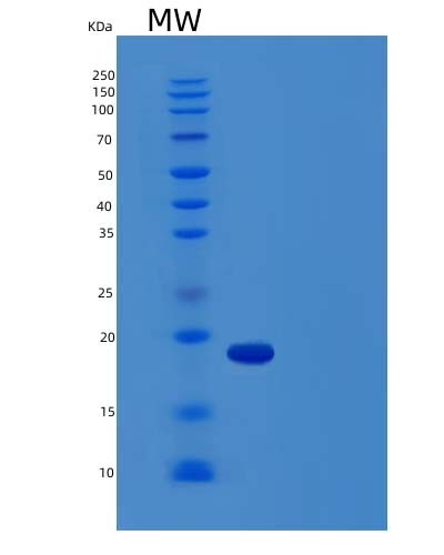 SDS-PAGE analysis of Human LTA (Lymphotoxin-Alpha) - Recombinant Protein, CAT# BLT-04343P, showing >85% purity under 15% SDS-PAGE (Reduced)Human LTA (Lymphotoxin-Alpha) - Recombinant Protein