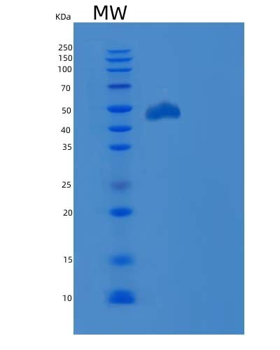 SDS-PAGE analysis of Human CD274 (Programmed Cell Death 1 Ligand 1) - Recombinant Protein, CAT# BLT-04396P, showing >85% purity under 15% SDS-PAGE (Reduced)Human CD274 (Programmed Cell Death 1 Ligand 1) - Recombinant Protein