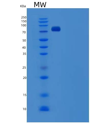 SDS-PAGE analysis of Human SCARB1 (Scavenger Receptor Class B Member 1) - Recombinant Protein, CAT# BLT-04402P, showing >85% purity under 15% SDS-PAGE (Reduced)Human SCARB1 (Scavenger Receptor Class B Member 1) - Recombinant Protein
