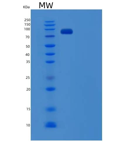 SDS-PAGE analysis of Human USP5 (Ubiquitin Carboxyl-Terminal Hydrolase 5) - Recombinant Protein, CAT# BLT-04406P, showing >90% purity under 15% SDS-PAGE (Reduced)Human USP5 (Ubiquitin Carboxyl-Terminal Hydrolase 5) - Recombinant Protein