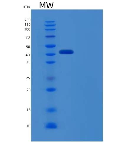 SDS-PAGE analysis of Human IFNAR1 (Interferon Alpha/Beta Receptor 1) - Recombinant Protein, CAT# BLT-04413P, showing >85% purity under 15% SDS-PAGE (Reduced)Human IFNAR1 (Interferon Alpha/Beta Receptor 1) - Recombinant Protein