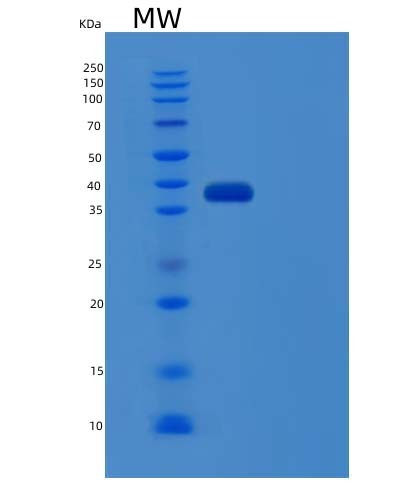 SDS-PAGE analysis of Human CFHR1 (Complement Factor H-Related Protein 1) - Recombinant Protein, CAT# BLT-04414P, showing >95% purity under 15% SDS-PAGE (Reduced)Human CFHR1 (Complement Factor H-Related Protein 1) - Recombinant Protein