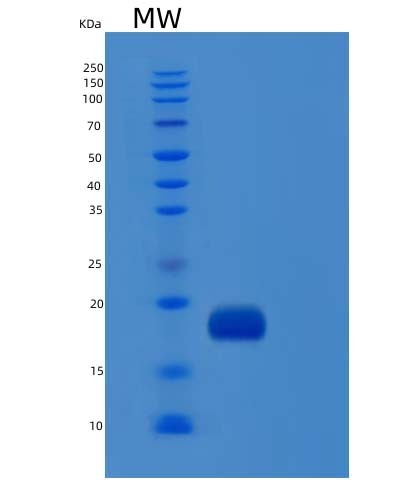 SDS-PAGE analysis of Human IL1F10 (Interleukin-1 Family Member 10) - Recombinant Protein, CAT# BLT-05098P, showing >90% purity under 15% SDS-PAGE (Reduced)Human IL1F10 (Interleukin-1 Family Member 10) - Recombinant Protein
