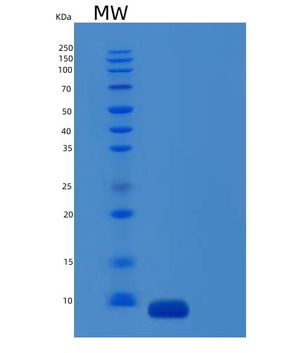 SDS-PAGE analysis of Mouse C5 (Complement C5) - Recombinant Protein, CAT# BLT-04420P, showing >95% purity under 15% SDS-PAGE (Reduced)Mouse C5 (Complement C5) - Recombinant Protein