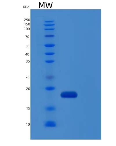 SDS-PAGE analysis of Human IL36G (Interleukin-36 Gamma) - Recombinant Protein, CAT# BLT-04421P, showing >90% purity under 15% SDS-PAGE (Reduced)Human IL36G (Interleukin-36 Gamma) - Recombinant Protein