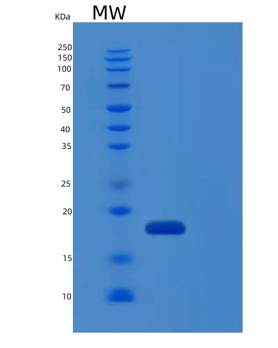 SDS-PAGE analysis of Human IL1RN (Interleukin-1 Receptor Antagonist Protein) - Recombinant Protein, CAT# BLT-04422P, showing >85% purity under 15% SDS-PAGE (Reduced)Human IL1RN (Interleukin-1 Receptor Antagonist Protein) - Recombinant Protein