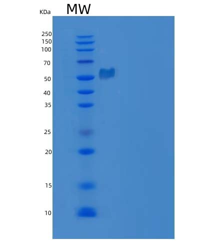 SDS-PAGE analysis of Human ACAT2 (Acetyl-Coa Acetyltransferase, Cytosolic) - Recombinant Protein, CAT# BLT-04461P, showing >90% purity under 15% SDS-PAGE (Reduced)Human ACAT2 (Acetyl-Coa Acetyltransferase, Cytosolic) - Recombinant Protein