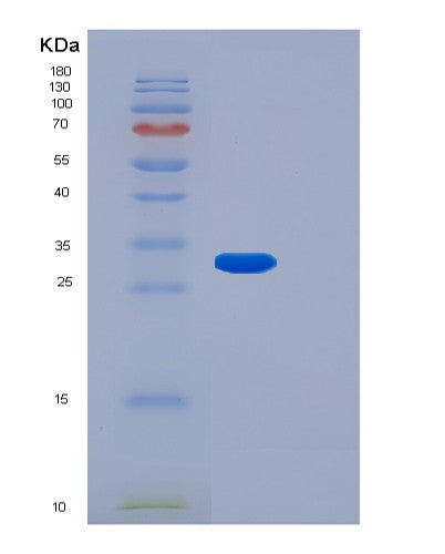 SDS-PAGE analysis of Human FGF14 (Fibroblast Growth Factor 14) - Recombinant Protein, CATHuman FGF14 (Fibroblast Growth Factor 14) - Recombinant Protein
