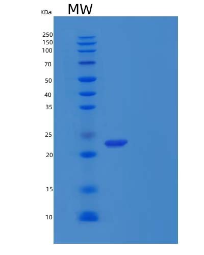 SDS-PAGE analysis of Human CTHRC1 (Collagen Triple Helix Repeat-Containing Protein 1) - Recombinant Protein, CAT# BLT-04552P, showing >90% purity under 15% SDS-PAGE (Reduced)Human CTHRC1 (Collagen Triple Helix Repeat-Containing Protein 1) - Recombinant Protein