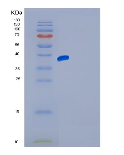 SDS-PAGE analysis of Human FGFR4 (Fibroblast Growth Factor Receptor 4) - Recombinant Protein, CAT# BLT-01083P, showing >90% purity under 15% SDS-PAGE (Reduced)Human FGFR4 (Fibroblast Growth Factor Receptor 4) - Recombinant Protein