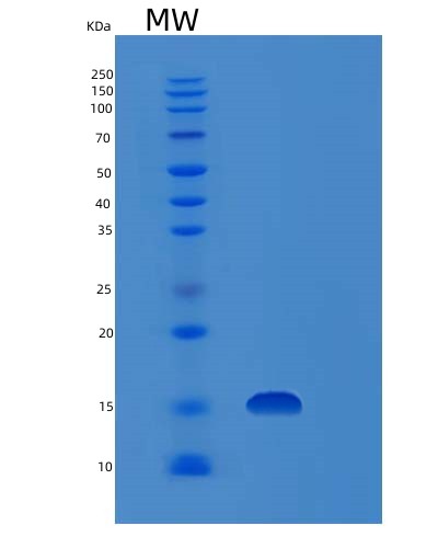 SDS-PAGE analysis of Human FHIT (Bis(5'-Adenosyl)-Triphosphatase) - Recombinant Protein, CAT# BLT-01085P, showing >85% purity under 15% SDS-PAGE (Reduced)Human FHIT (Bis(5'-Adenosyl)-Triphosphatase) - Recombinant Protein