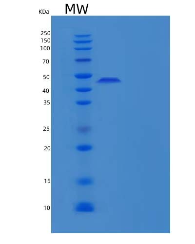 SDS-PAGE analysis of Human SMPDL3A (Cyclic Gmp-Amp Phosphodiesterase Smpdl3A) - Recombinant Protein, CAT# BLT-04572P, showing >95% purity under 15% SDS-PAGE (Reduced)Human SMPDL3A (Cyclic Gmp-Amp Phosphodiesterase Smpdl3A) - Recombinant Protein