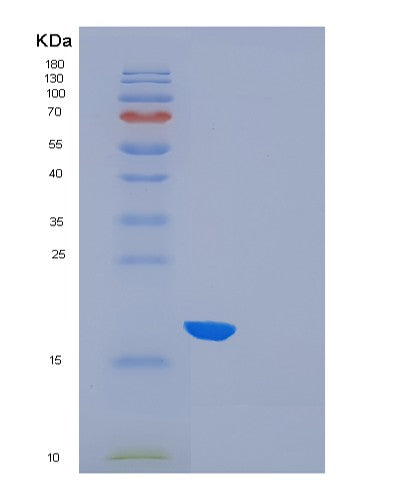 SDS-PAGE analysis of Human FLT3LG (Fms-Related Tyrosine Kinase 3 Ligand) - Recombinant Protein, CATHuman FLT3LG (Fms-Related Tyrosine Kinase 3 Ligand) - Recombinant Protein