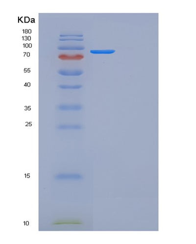 SDS-PAGE analysis of Mouse Folh1 (Glutamate Carboxypeptidase 2) - Recombinant Protein, CAT# BLT-01102P, showing >90% purity under 15% SDS-PAGE (Reduced)Mouse Folh1 (Glutamate Carboxypeptidase 2) - Recombinant Protein