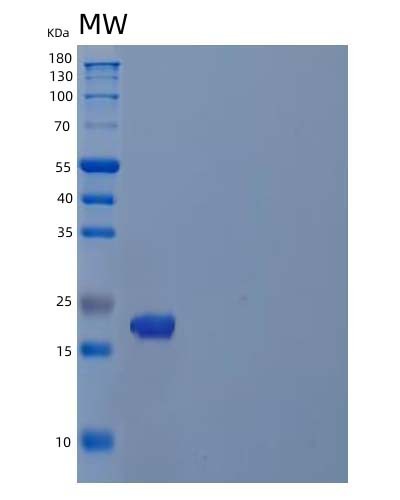 SDS-PAGE analysis of Human PDAP1 (28 Kda Heat- And Acid-Stable Phosphoprotein) - Recombinant Protein, CAT# BLT-04582P, showing >90% purity under 15% SDS-PAGE (Reduced)Human PDAP1 (28 Kda Heat- And Acid-Stable Phosphoprotein) - Recombinant Protein