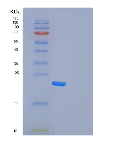 SDS-PAGE analysis of Human FXN (Frataxin, Mitochondrial) - Recombinant Protein, CATHuman FXN (Frataxin, Mitochondrial) - Recombinant Protein
