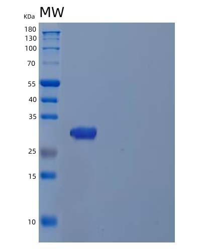 SDS-PAGE analysis of Human TPSAB1 (Tryptase Alpha/Beta-1) - Recombinant Protein, CAT# BLT-04583P, showing >85% purity under 15% SDS-PAGE (Reduced)Human TPSAB1 (Tryptase Alpha/Beta-1) - Recombinant Protein