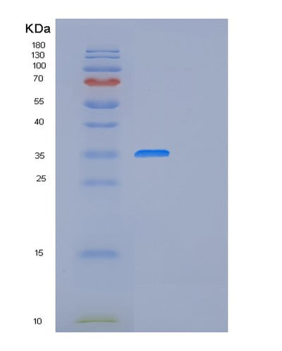 SDS-PAGE analysis of Human FRZB (Secreted Frizzled-Related Protein 3) - Recombinant Protein, CAT# BLT-01109P, showing >85% purity under 15% SDS-PAGE (Reduced)Human FRZB (Secreted Frizzled-Related Protein 3) - Recombinant Protein