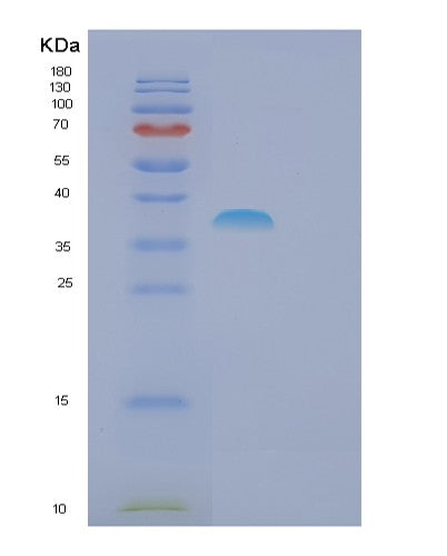 SDS-PAGE analysis of Human FSBP (Fibrinogen Silencer-Binding Protein) - Recombinant Protein, CATHuman FSBP (Fibrinogen Silencer-Binding Protein) - Recombinant Protein