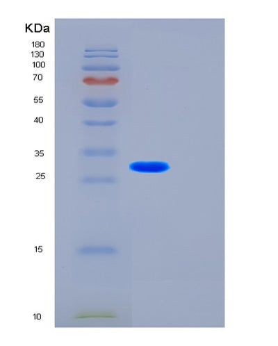 SDS-PAGE analysis of Human FST (Follistatin) - Recombinant Protein, CAT# BLT-01112P, showing >85% purity under 15% SDS-PAGE (Reduced)Human FST (Follistatin) - Recombinant Protein